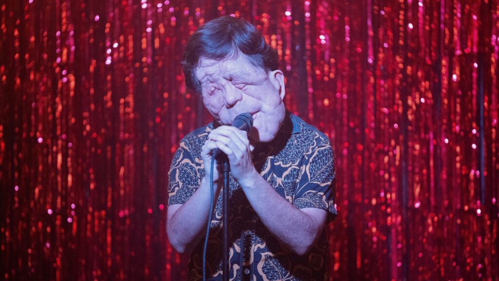 A Different Man (A24) Adam Pearson